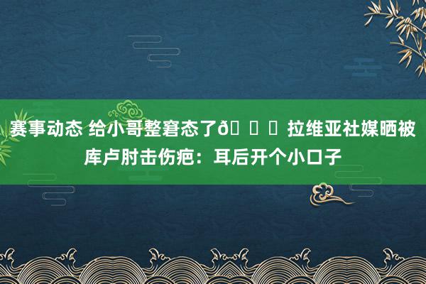 赛事动态 给小哥整窘态了😅拉维亚社媒晒被库卢肘击伤疤：耳后开个小口子